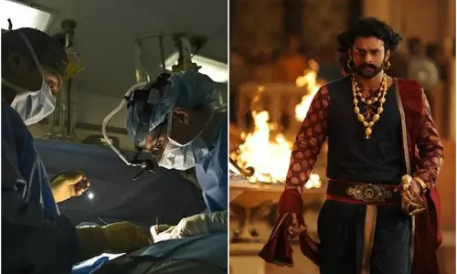 ശസ്ത്രക്രിയയ്ക്കിടയില്‍ രോഗി ബാഹുബലി -2 സിനിമ കണ്ടു