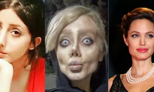 ആഞ്ചലീന ജോളിയാകാന്‍ 50 ശസ്ത്രക്രിയകള്‍! സത്യമിതാണ്..