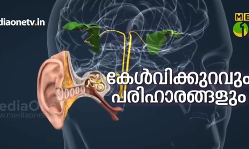കേള്‍വിക്കുറവും പരിഹാരങ്ങളും