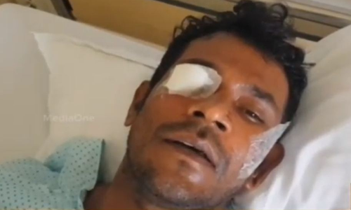 ആലുവ പൊലീസ് മര്‍ദ്ദനം; ഉസ്മാന് ജാമ്യം 