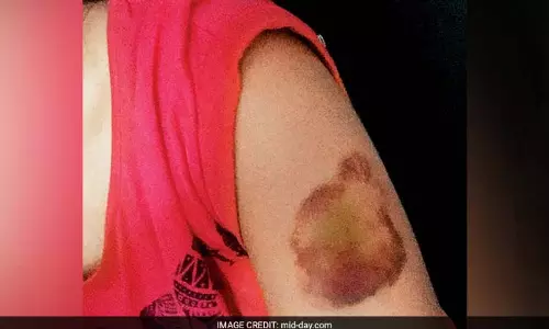 മാന്യമായ വസ്ത്രം ധരിക്കണം, അന്യപുരുഷന്മാര്‍ക്കൊപ്പം ചുറ്റിക്കറങ്ങരുത്; യുവതിക്ക് നേരെ അഞ്ചംഗ സംഘത്തിന്റെ ആക്രമണം