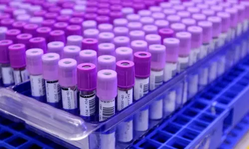 ജനങ്ങളുടെ ജനിതക സാമ്പിളുകള്‍ ശേഖരിക്കുന്നതിനെതിരെ കുവൈത്ത്  എംപി