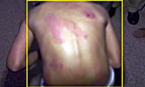 ഗൃഹപാഠം ചെയ്തില്ല, 7 വയസുകാരിക്ക് ട്യൂഷന് ടീച്ചറുടെ ബെല്റ്റ് കൊണ്ടുള്ള മര്ദ്ദനം ഗൃഹപാഠം ചെയ്തില്ല, 7 വയസുകാരിക്ക് ട്യൂഷന് ടീച്ചറുടെ ബെല്റ്റ് കൊണ്ടുള്ള മര്ദ്ദനം