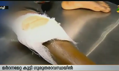 അമ്മയുടെ ക്രൂരമര്‍ദനമേറ്റ 9 വയസുകാരന്‍ ഗുരുതരാവസ്ഥയില്‍