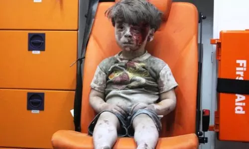 അലപ്പോ വ്യോമാക്രമണം: പരിക്കേറ്റ ഉംറാന്റെ സഹോദരന്‍ മരിച്ചു