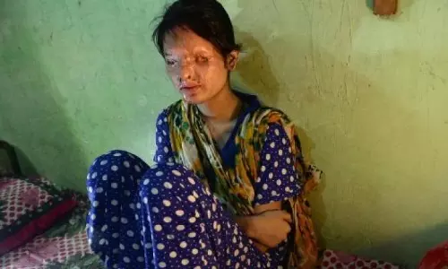 ചങ്കൂറ്റമാണ് ഇവളുടെ സൌന്ദര്യം, ക്യാറ്റ് വാക്കിനൊരുങ്ങി ആസിഡ് ആക്രമണത്തിലെ ഇര