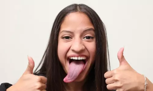 ഈ പെണ്‍കുട്ടിക്ക് കഴുത്തിന് ചുറ്റുമാണ് നാക്ക്