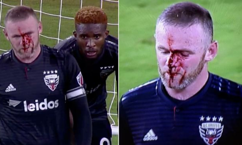 അമേരിക്കയില്‍ റൂണി ഗോളടിച്ചു;പക്ഷേ മൂക്ക് പൊട്ടി 