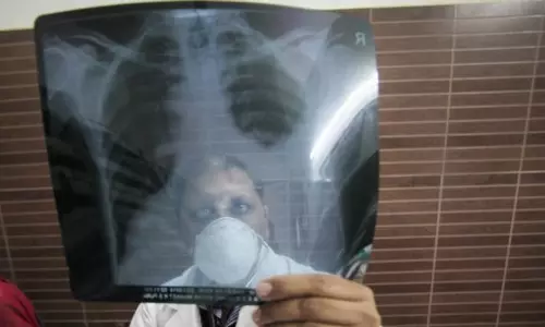 കുവൈത്തില്‍ ജനസംഖ്യയുടെ 33 ശതമാനം പേര്‍ ക്ഷയരോഗബാധിതരെന്ന് റിപ്പോര്‍ട്ട്