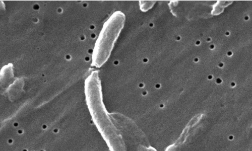 മലപ്പുറത്ത് കോളറ സ്ഥിരീകരിച്ചതായി ആരോഗ്യമന്ത്രി