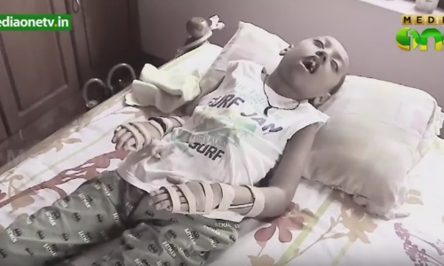 കരിക്കകം അപകടം: ഓര്‍മയും ചലനവും നഷ്ടപ്പെട്ട് ഇര്‍ഫാന്‍