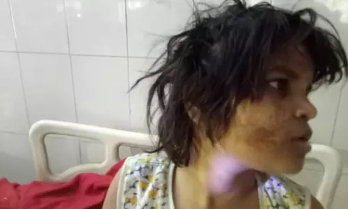 വന്യജീവിസങ്കേതത്തില് കുരങ്ങുകള്ക്കൊപ്പം ജീവിച്ചിരുന്ന പെണ്കുട്ടിയെ രക്ഷിച്ചു വന്യജീവിസങ്കേതത്തില് കുരങ്ങുകള്ക്കൊപ്പം ജീവിച്ചിരുന്ന പെണ്കുട്ടിയെ രക്ഷിച്ചു