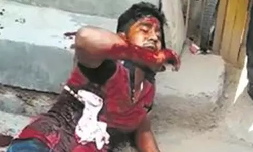 കത്തിക്കുത്തേറ്റ് റോഡരികില്‍ കിടന്ന യുവാവ് വെള്ളത്തിനായി യാചിച്ചു, കണ്ടുനിന്നവര്‍ ഫോണില്‍ പകര്‍ത്തി