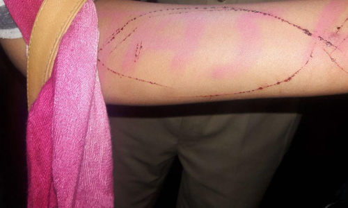 കയ്യില് ബ്ലൂ വെയില് വരഞ്ഞ് ആത്മഹത്യാശ്രമം നടത്തിയ പെണ്കുട്ടിയെ രക്ഷപ്പെടുത്തി കയ്യില് ബ്ലൂ വെയില് വരഞ്ഞ് ആത്മഹത്യാശ്രമം നടത്തിയ പെണ്കുട്ടിയെ രക്ഷപ്പെടുത്തി