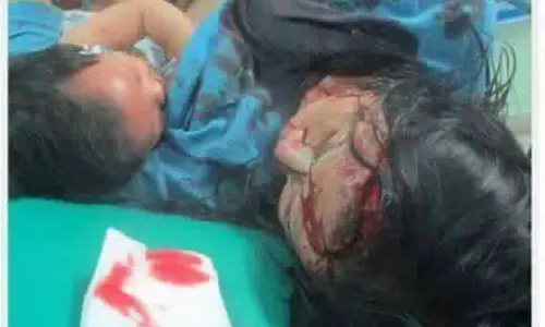 ഇതാണ് അമ്മയുടെ സ്നേഹം, ഗുരുതരമായി പരിക്കേറ്റ യുവതി പ്രഥമ ശുശ്രൂഷയ്ക്കും മുമ്പ് കുഞ്ഞിന് മുലയൂട്ടുന്ന ദൃശ്യം വൈറലാകുന്നു ഇതാണ് അമ്മയുടെ സ്നേഹം, ഗുരുതരമായി പരിക്കേറ്റ യുവതി പ്രഥമ ശുശ്രൂഷയ്ക്കും മുമ്പ് കുഞ്ഞിന് മുലയൂട്ടുന്ന ദൃശ്യം വൈറലാകുന്നു