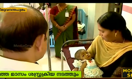 ഒടുവില്‍ കൊച്ചു ദയയുടെ കരള്‍ മാറ്റിവയ്ക്കല്‍ ശസ്ത്രക്രിയക്ക് സാമ്പത്തിക സഹായം