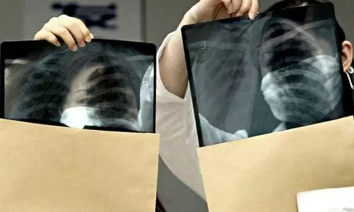 അബൂദബിയില്‍ ഭക്ഷ്യമേഖലയിലെ തൊഴില്‍ വിസക്കുള്ള ഹെപ്പറ്റൈറ്റിസ് ബി പരിശോധന ഒഴിവാക്കി