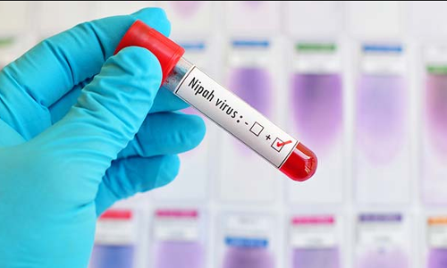 നിപാ വൈറസിന്റെ ഉറവിടം ; അന്വേഷണം ഊര്‍ജ്ജിതം