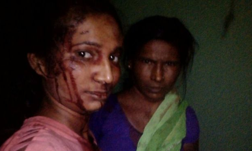 ആടിനെ രക്ഷിക്കാന്‍ കടുവയോട് പോരാടി; താരമായി യുവതി