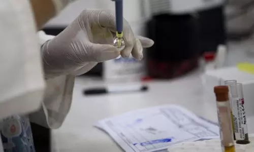 സിക വൈറസ്: വാക്സിന്‍ വികസപ്പിക്കാന്‍ യുഎസ് 81 മില്യണ്‍ ഡോളര്‍ അനുവദിച്ചു