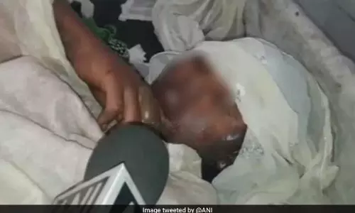 ബലാത്സംഗം ചെറുത്ത പെണ്‍കുട്ടിയെ തീ കൊളുത്തി കൊല്ലാന്‍ ശ്രമം