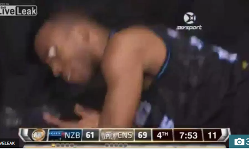 ബാസ്‌ക്കറ്റ് ബോള്‍ കളിക്കിടെ കളിക്കാരന്റെ കൃഷ്ണമണി പുറത്തേക്ക് തൂങ്ങി