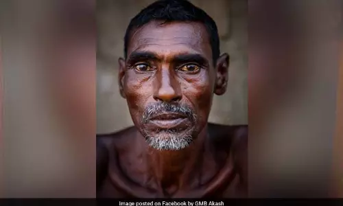 ഇനി ഞാന്‍ ദരിദ്രനല്ല; കണ്ണ് നനയ്ക്കും ഈ അതിജീവനകഥ