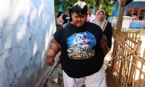 ഈ പത്ത് വയസുകാരന്റെ ഭാരം 190 കിഗ്രാം- ന്യൂഡില്‍സും കോളയും ഇഷ്ടഭക്ഷണം