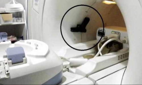 യുപി മന്ത്രിയുടെ ആശുപത്രിവാസം; 15ലക്ഷം രൂപയുടെ നാശനഷ്ടം