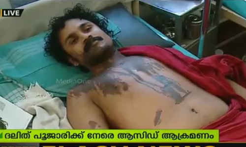 പട്ടാമ്പിയില്‍ ദലിത് പൂജാരിക്ക് നേരെ ആസിഡ് ആക്രമണം