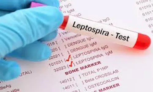 എലിപ്പനി, പ്രതിരോധ പ്രവര്ത്തനങ്ങള് ഊര്ജ്ജിതമാക്കി ആരോഗ്യവകുപ്പ്; ഇന്നലെ മാത്രം മരിച്ചത് ആറ് പേര് എലിപ്പനി, പ്രതിരോധ പ്രവര്ത്തനങ്ങള് ഊര്ജ്ജിതമാക്കി ആരോഗ്യവകുപ്പ്; ഇന്നലെ മാത്രം മരിച്ചത് ആറ് പേര്