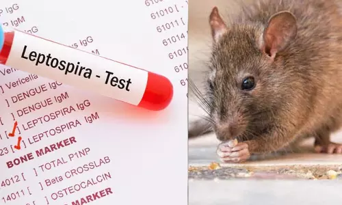 എലിപ്പനി: മനുഷ്യർക്ക് അണുബാധ ഉണ്ടാകുന്നത് എങ്ങനെ