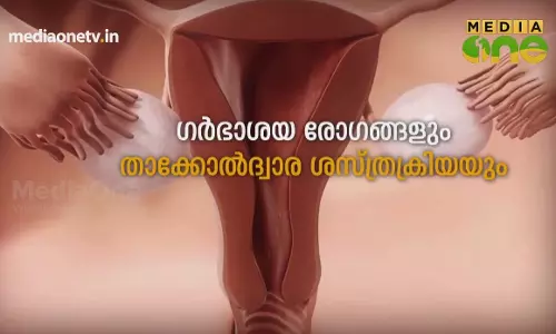 Stethoscope | ഗർഭാശയ രോഗങ്ങളും താക്കോൽദ്വാര ശസ്ത്രക്രിയയും | Episode 230 Stethoscope | ഗർഭാശയ രോഗങ്ങളും താക്കോൽദ്വാര ശസ്ത്രക്രിയയും | Episode 230