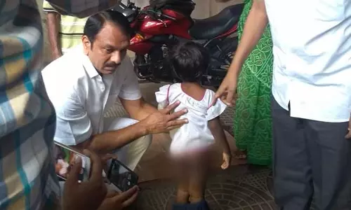 ഭക്ഷണം കഴിച്ചുകൊണ്ടിരിക്കുമ്പോഴാണ് അച്ഛന്‍ പൊള്ളിച്ചത്: രണ്ടാനച്ഛന്റെ ക്രൂരതയ്ക്ക് ഇരയായ നാലുവയസ്സുകാരി