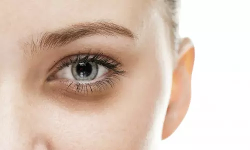 കണ്ണിന് ചുറ്റുമുള്ള കറുത്ത പാട് ഒഴിവാക്കണോ? പരിഹാരമുണ്ട് 