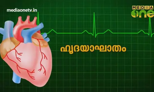 ഹാർട്ട് അറ്റാക്ക് | Stethoscope (Episode 232) ഹാർട്ട് അറ്റാക്ക് | Stethoscope (Episode 232)