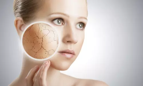 മഞ്ഞുകാലത്തെ വരണ്ട ചര്‍മ്മമോ?  പരിഹാരമിതാ