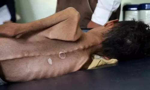 യമനില്‍ ഏഴ് മില്യണിലധികം  കുട്ടികള്‍ ഗുരുതര പട്ടിണിയിലെന്ന് യു.എന്‍ മുന്നറിയിപ്പ്