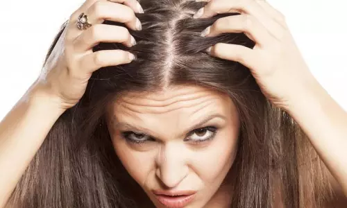 പൊടി പോലുമുണ്ടാകില്ല കണ്ടുപിടിക്കാന്‍;താരനകറ്റാനുള്ള ടിപ്സുമായി വിനോദ്