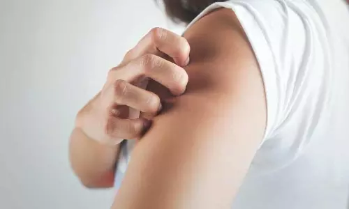 രണ്ട് തരം സൊറിയാസിസ് ചികിത്സകള് Psoriasis | Epi 33 രണ്ട് തരം സൊറിയാസിസ് ചികിത്സകള് Psoriasis | Epi 33