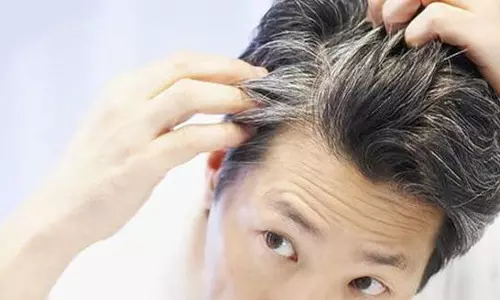 അകാലനരയ്ക്ക് മരുന്നുണ്ടോ?