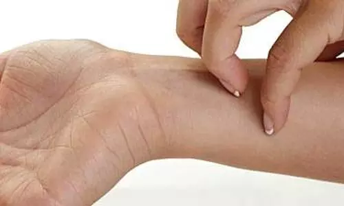 ചര്‍മരോഗങ്ങള്‍- കാരണങ്ങളും പരിഹാരങ്ങളും