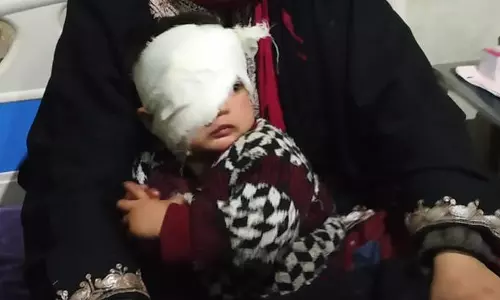 കശ്മീരില്‍ പെല്ലറ്റ് കൊണ്ട ഒന്നരവയസുകാരിയുടെ കാഴ്ച്ച നഷ്ടമായേക്കും