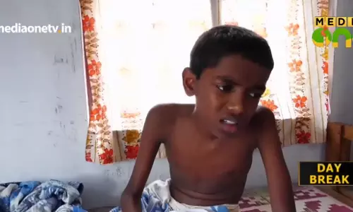 അപൂര്‍വ്വ രോഗം പിടിപ്പെട്ട നിഖില്‍ ചികിത്സസഹായം തേടുന്നു