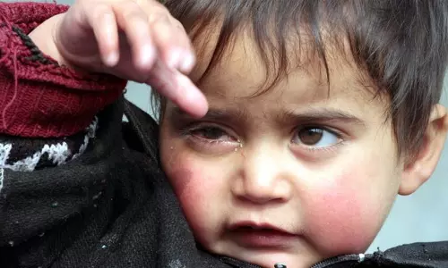 കാശ്മീരില്‍ സൈന്യത്തിന്റെ പെല്ലറ്റേറ്റ കുഞ്ഞു ഹിബയുടെ കാഴ്ച്ച പൂര്‍ണമായും നഷ്ടപ്പെടും