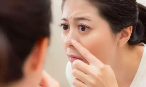 ബ്ലാക്ക് ഹെഡ്സ് പമ്പ കടക്കും; ഈ പൊടിക്കൈകള്‍ ഒന്നു പരീക്ഷിച്ചു നോക്കൂ