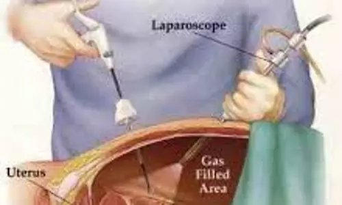 ലാപ്രോസ്കോപ്പിക്ക് സർജറി എന്താണ്?
