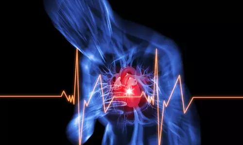 സൗദിയില്‍ മലയാളി യുവാവ് ഹൃദയാഘാതത്തെ തുടര്‍ന്ന് മരിച്ചു