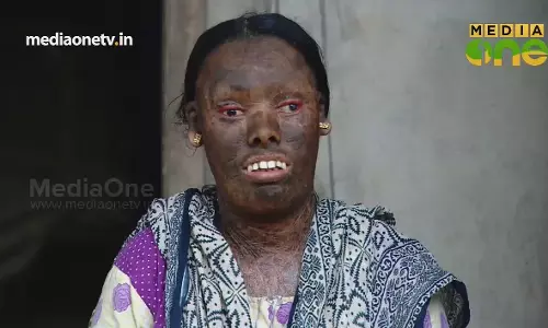 Snehasparsham | സ്നേഹസ്പർശം | Episode 31