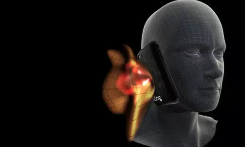 ഷോമി, വണ്‍ പ്ലസ്... ഏത് സ്മാര്‍ട്ട്‌ഫോണുകളാണ് റേഡിയേഷനില്‍ മുന്നില്‍?